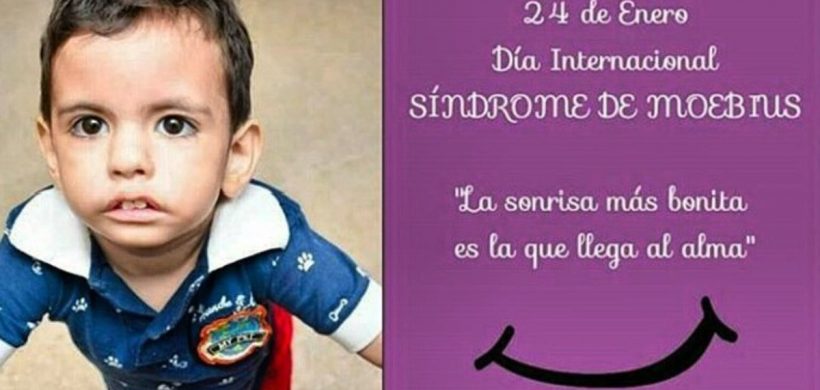 Día Mundial del Síndrome de Moebius
